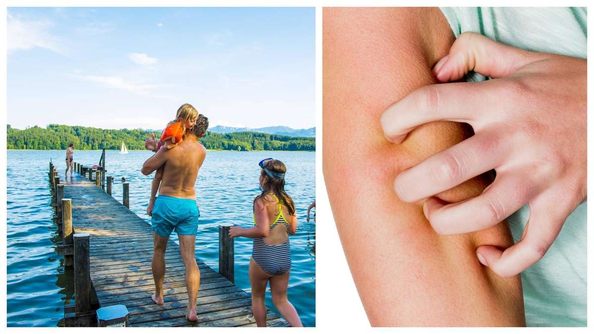 38916620 vater mit kindern am simssee hautausschlag nach dem baden zerkarien 4ef