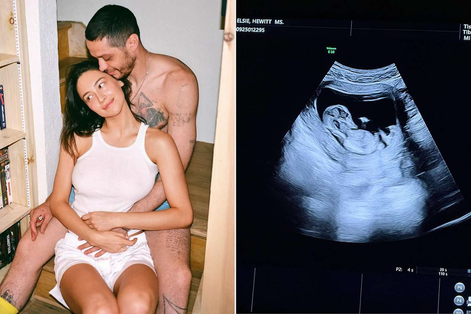 elsie hewitt pete davidson pregnancy 071625 99b10bc48ae049c6b86f388a2743babb
