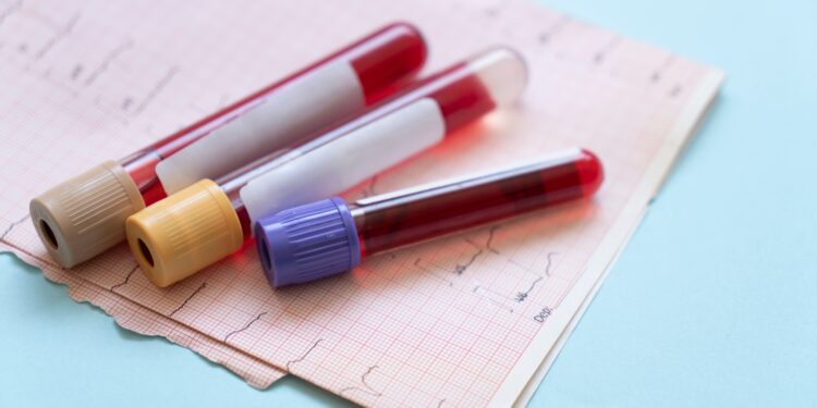 Value Investing Insights: Analyzing HIMS Stock Value Investing Insights: Analyzing HIMS Stock